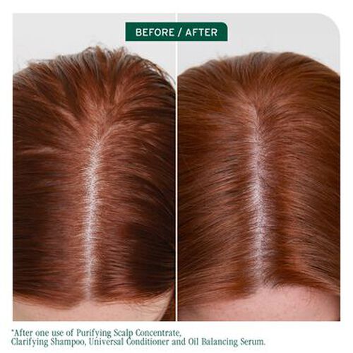 Scalp Sync Clarifying Shampoo - Biolage Renovation NZ | L'Or&eacute;al Partner Shop